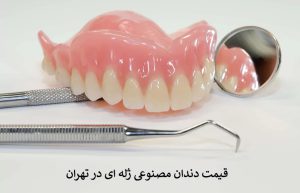 قیمت دندان مصنوعی ژله ای در تهران